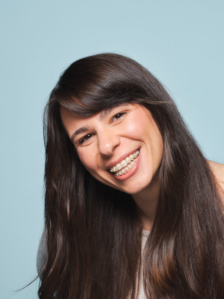 Adult female with LightForce Braces